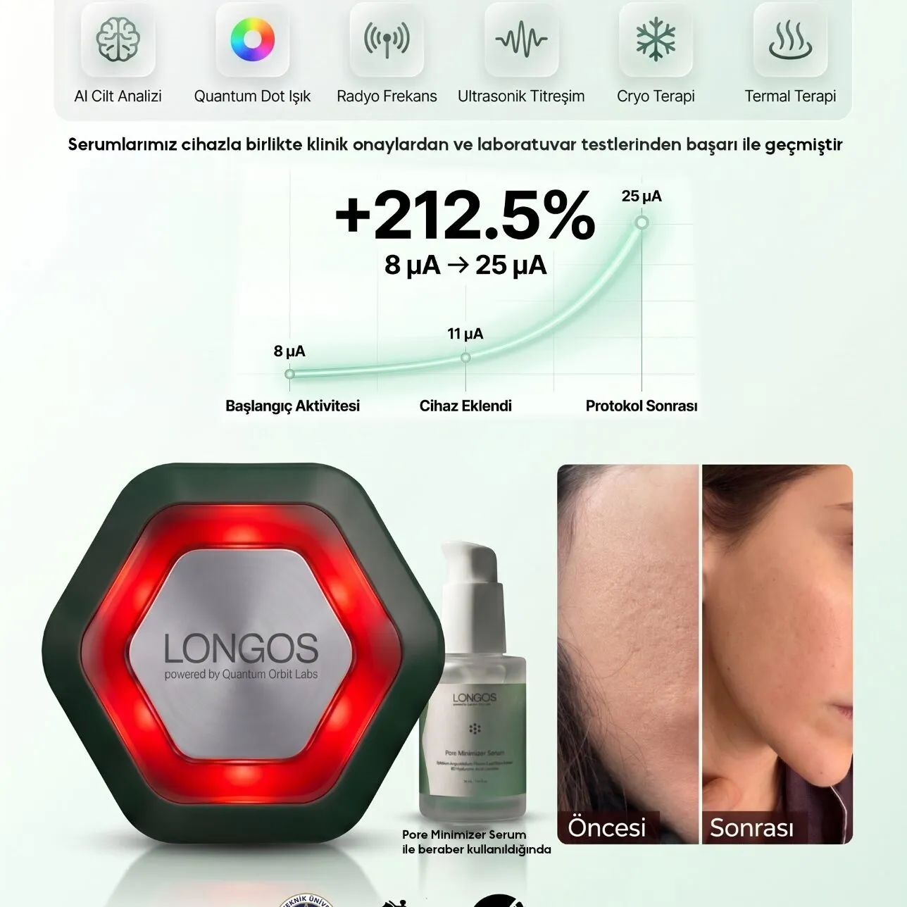 Longos Sense cihaz detayı